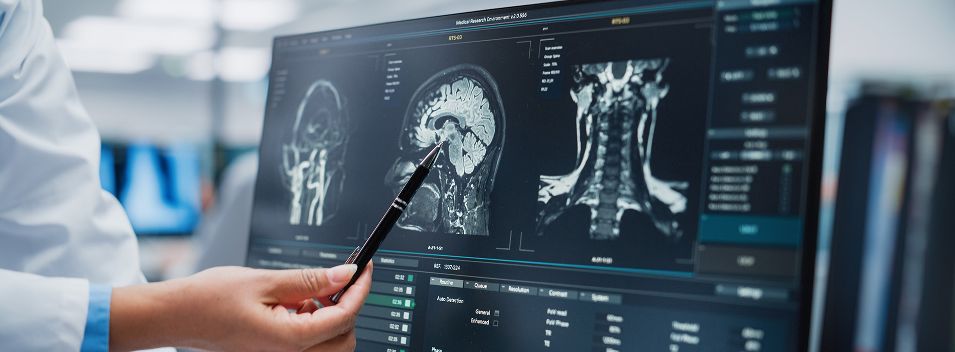 A medical professional interacting with a large digital display showing an MRI scan of a human brain, with a tablet stylus being used to navigate the image.