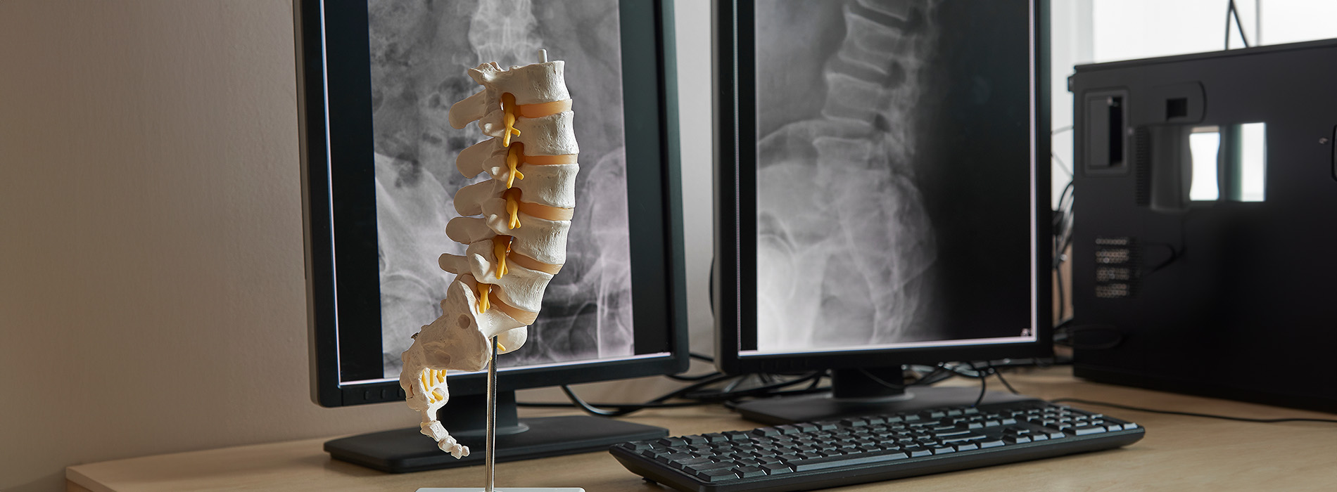 This image features a computer desk with two monitors displaying X-ray images, a keyboard, and a mouse. The monitors are placed on either side of a skeleton model that appears to be missing its skull, which is positioned in front of them.