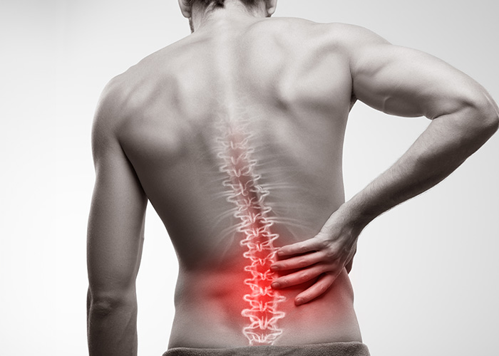 The image depicts a man with a visible spinal column, likely indicating a medical condition such as a herniated disc, standing against a white background with a red square on the right side.